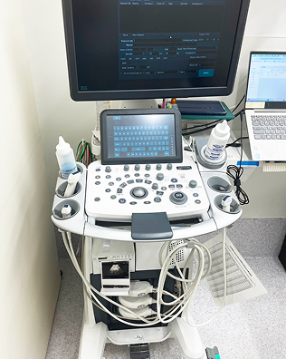 超音波診断装置