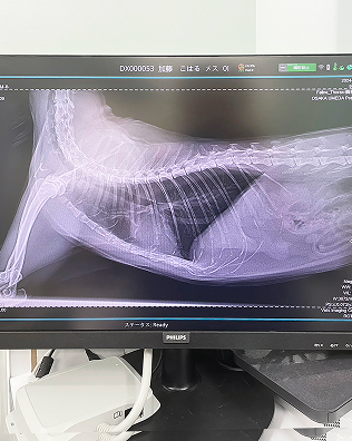 デジタルレントゲン